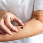 high-angle-hand-measuring-mole_23-2149359544