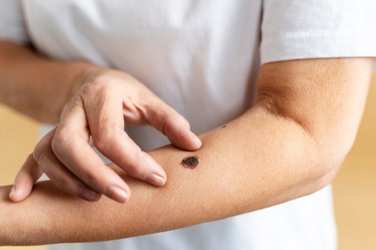 high-angle-hand-measuring-mole_23-2149359544